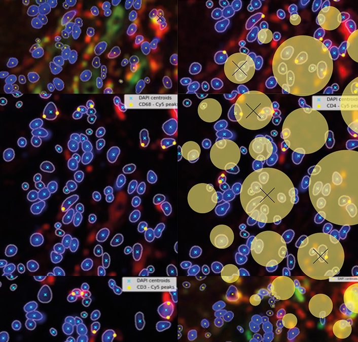 WHEN CELLS BECAME CODE: A computer scientist’s journey into digital pathology